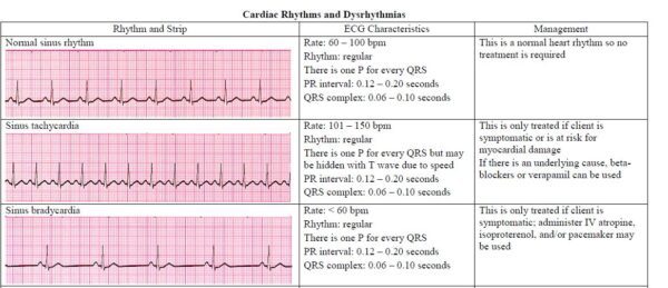 13 cardiac rhythm and dysrhythmias cheat sheet any nurse must know for the exam